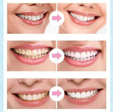 Load image into Gallery viewer, Dental Whitening Pen
