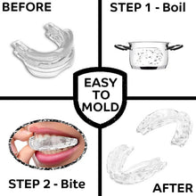 Load image into Gallery viewer, HexoSleep™ Mouth Guard For TMJ &amp; Jaw Pain Relief
