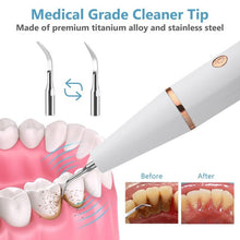 Load image into Gallery viewer, Ultrasonic Scaling Wand: Efficient and safe tooth cleaning at home with LED light and USB quick-charge function
