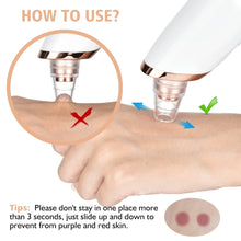 Load image into Gallery viewer, HexoClear™ Vacuum Blackhead Remover
