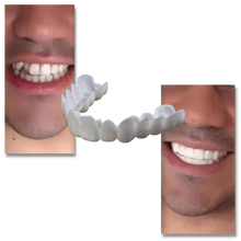Load image into Gallery viewer, Dental coverage for a perfect smile - comfortable aligners
