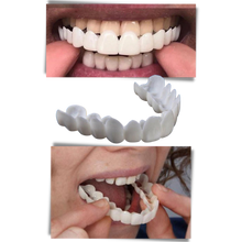 Load image into Gallery viewer, Dental coverage for a perfect smile - comfortable aligners
