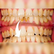 Load image into Gallery viewer, Professional Dental Scaler
