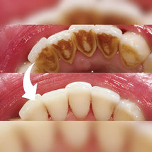 Load image into Gallery viewer, Professional Dental Scaler
