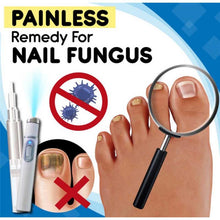 Load image into Gallery viewer, HexoNail™ Fungus Treatment Kit
