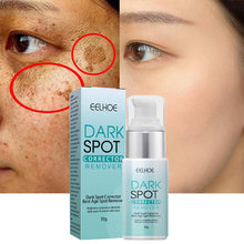 Load image into Gallery viewer, Anti-Dark Spot Skin Care Lightens Pigmentation Spots
