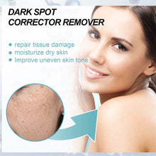 Load image into Gallery viewer, Anti-Dark Spot Skin Care Lightens Pigmentation Spots
