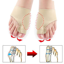 Load image into Gallery viewer, HexoBunion™ Orthopedic Corrector Sleeve (1 pair)
