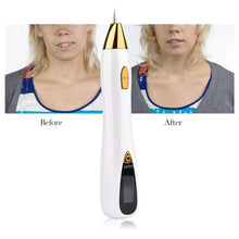 Load image into Gallery viewer, HexoPlasma™️ Mole Removal Pen
