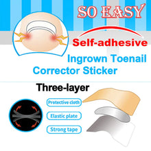 Load image into Gallery viewer, Easy Patches - Correction Patches For Beautiful And Healthy Nails
