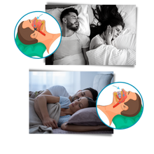 Load image into Gallery viewer, Advanced anti-snoring device
