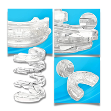 Load image into Gallery viewer, Advanced anti-snoring device
