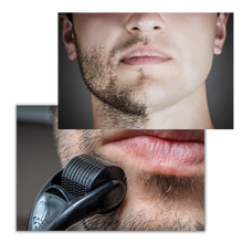 Load image into Gallery viewer, Dermal Roller For Hair And Beard Growth
