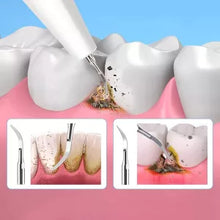 Load image into Gallery viewer, Ultrasonic scaler
