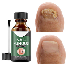 Load image into Gallery viewer, Goodbye Fungus
