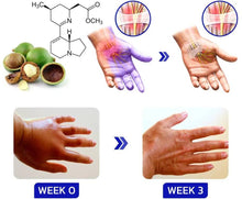 Load image into Gallery viewer, 2 Set Neuropathy Cream for Hands and Feet
