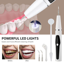 Load image into Gallery viewer, HexoTeeth™ Ultrasonic Tooth Cleaner
