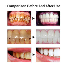 Load image into Gallery viewer, HexoTeeth™ Ultrasonic Tooth Cleaner
