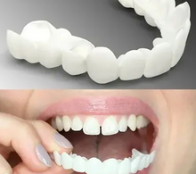 Load image into Gallery viewer, Adjustable Snap-On Dentures
