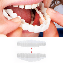 Load image into Gallery viewer, Smile Veneer (Upper &amp; Lower Included)
