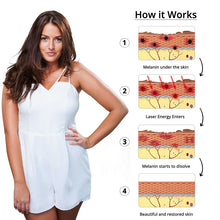 Load image into Gallery viewer, Tattoo Removal Laser
