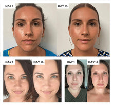 Load image into Gallery viewer, HexoSkin™ Anti-Aging Skincare Wand
