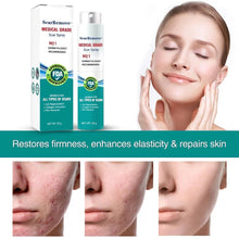 Load image into Gallery viewer, Advanced Scar Spray For All Types of Scars
