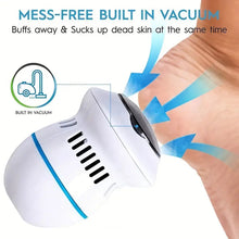 Load image into Gallery viewer, Foot Smoothie - Cracked Heels Treatment
