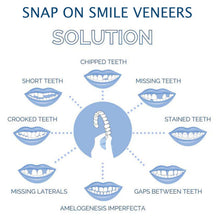 Load image into Gallery viewer, Smile Veneer (Upper &amp; Lower Included)
