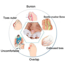 Load image into Gallery viewer, Orthopedic Toe Corrector - Toe Separator
