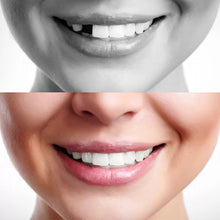 Load image into Gallery viewer, Original Moldable False Teeth
